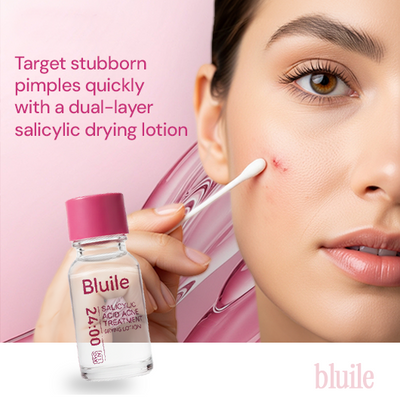 Salicylic Acid Acne Drying Lotion – Fast-Acting
